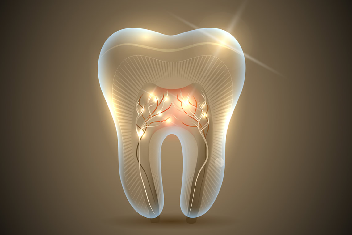 Root Canal Therapy